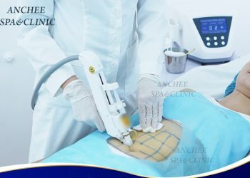 Tiêm Tan Mỡ Bụng Là Gì? Hiệu Quả Tiêm Tan Mỡ Bụng Giữ Được Bao Lâu?