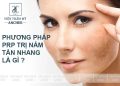 PRP giá bao nhiêu